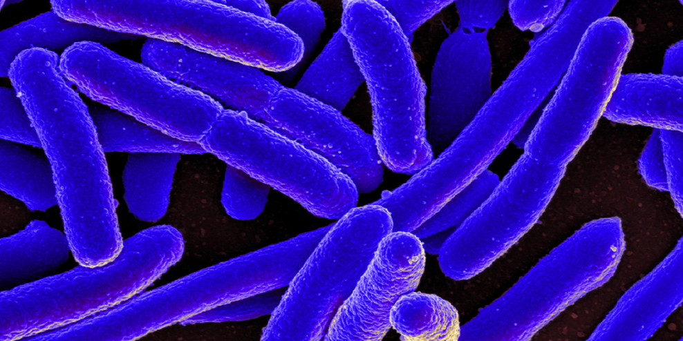 A purple, closeup photo of microscopic E. coli bacteria.